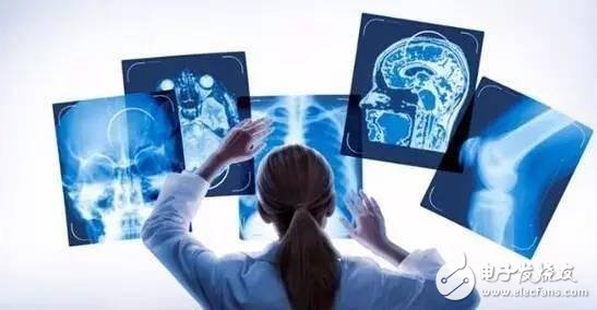 当人工智能遇上医疗影像,中国影像AI的探索与发展