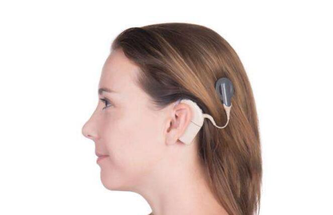 FDA批准首个远程设定电子耳蜗程序的医疗方
