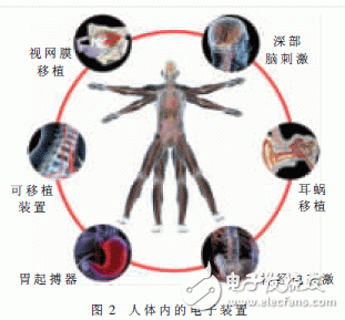 醫(yī)療電子的六大未來發(fā)展趨勢詳解