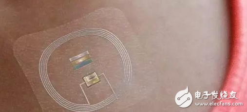 生物传感器有什么特点?在医疗领域中有哪些应用?