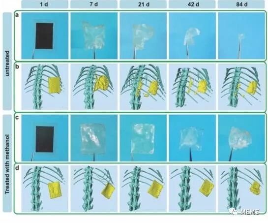 基于天然材料的生物全可吸收摩擦纳米发电机，起到什么作用？