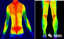 红外热成像技术能看到人体疼痛位置
