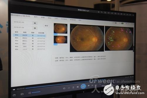 互联网医疗公司至真互联AI赋能眼科医疗行业