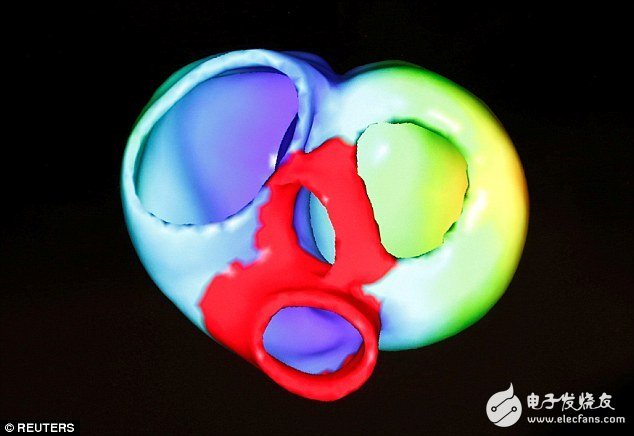 西门子对心脏进行数字3D打印,助力医生诊断更精确