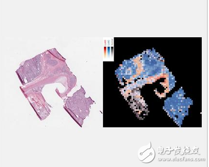 人工智能在醫學領域應用新突破:助力肺癌的診斷,減輕醫生的壓力