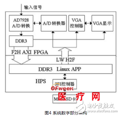 基于SoC FPGA的心电信号检测系统设计详解