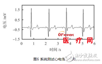 基于SoC FPGA的心电信号检测系统设计详解