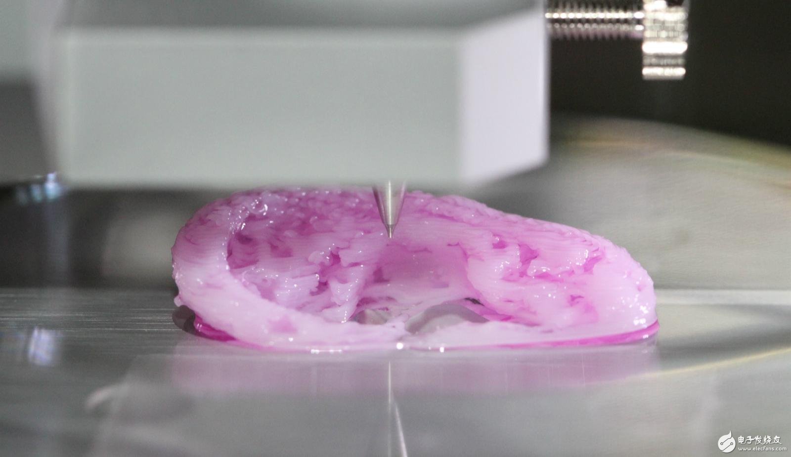 双管道模式的生物3D打印在医疗临床的应用