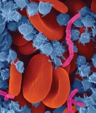 杜克大学医院将正式启用Sepsis Watch对...
