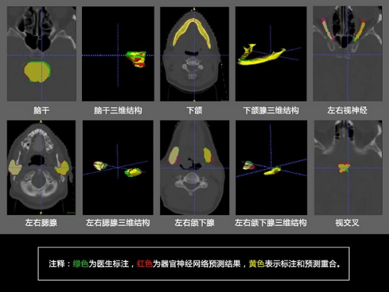 腾讯医疗AI助力靶向治疗 大幅减少了医生的工作时...