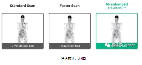 深透医疗AI影像产品获FDA认证 中国背景AI医...