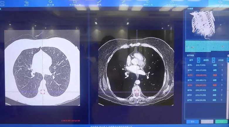 腾讯联合华银健康研发AI病理诊断 开放合作推动医学AI不断创新