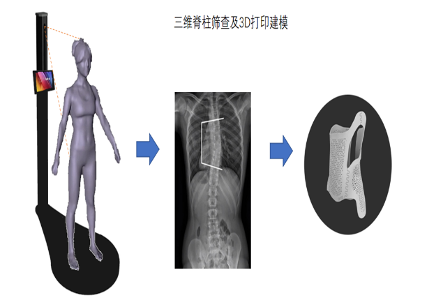 步影医疗聚焦青少年脊柱侧弯病种 实现疾病的早发现、早干预、早治疗