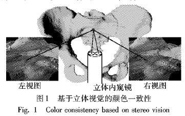 基于双目视觉的盆腔微创手术增强现实导航仿真系统的设计