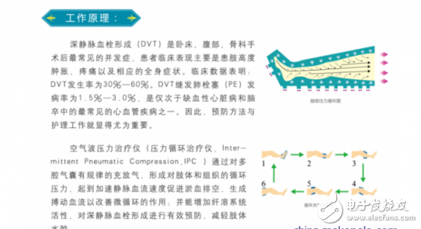 氣體流量傳感器助力空氣波壓力治療儀治療把控