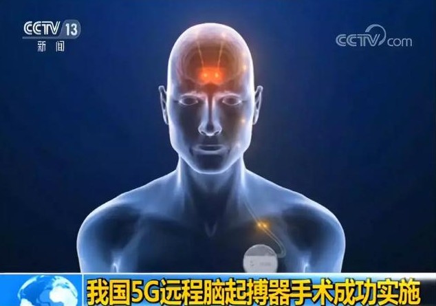 当5G与医疗联合,会擦出怎样的火花?