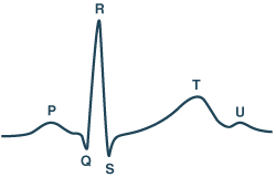 心电图