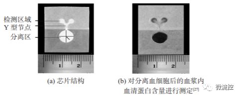用于血细胞分离和血清蛋白检测的纸基微流控芯片