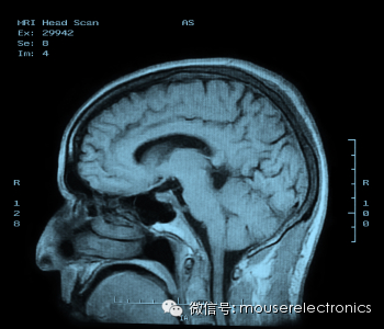 分享医学影像技术的原理及应用