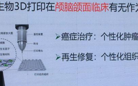3D打印技术让医疗产业进入个性定制时代