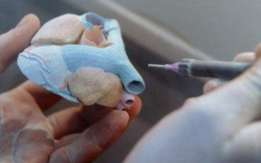 研究人员通过血管3D打印技术制造出了活体皮肤