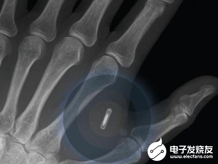 植入式医疗设备将能兼容Wi-Fi与ZigBee的...
