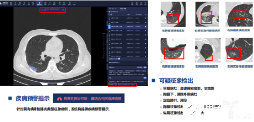 CT+AI AI影像市场逐渐成熟