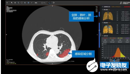 CT+AI AI影像市场逐渐成熟