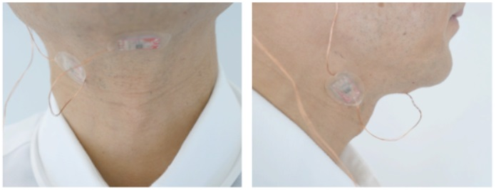 东大索尼共同研发出AI系统Derma 传感器贴合在喉咙把口形转为声音