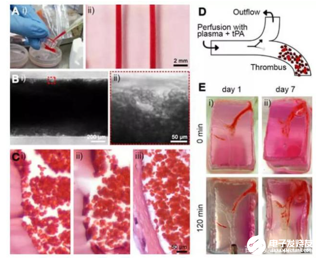 通過(guò)3D打印技術(shù)實(shí)現(xiàn)的高度仿生的血栓-芯片模型