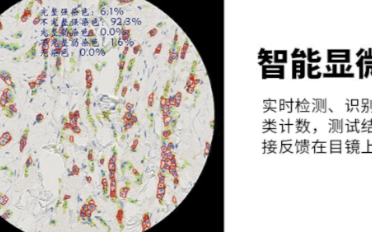腾讯推出临床应用智能显微镜,可在视野中直接显示数据