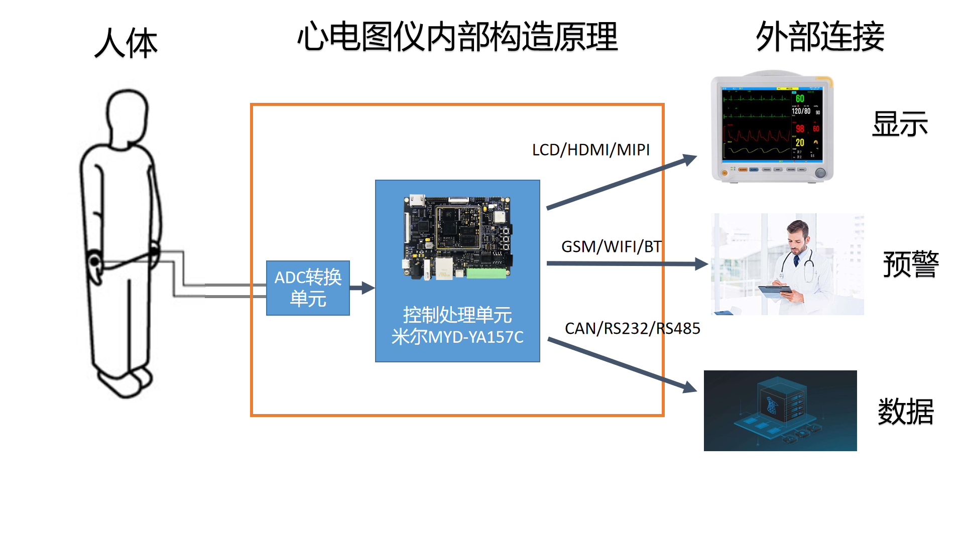 心电监护仪