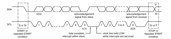 SCL