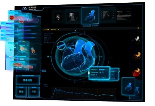 数坤科技利用冠脉 FFRct 的功能实现针对三大疾病相关解决方案的落地