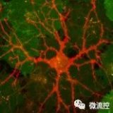 新型生物传感器可检测多巴胺