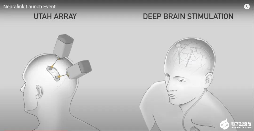 脑机接口:大脑植入装置是否实现"隔空探物","心灵感应"吗?
