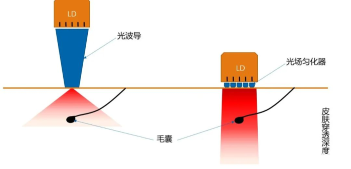 激光器