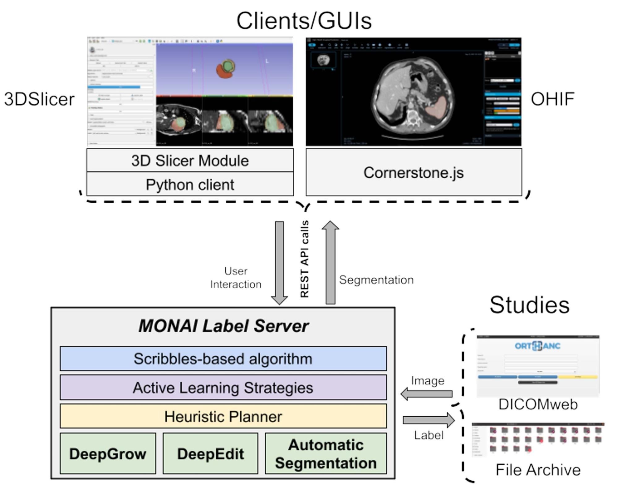 MONAI如何推动医学人工智能工作流的开放研究