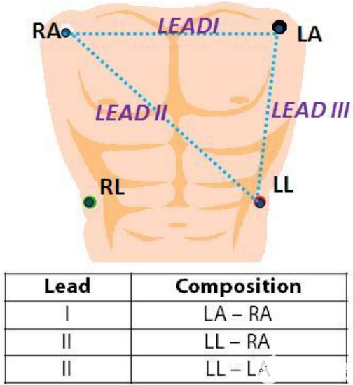 患者監(jiān)護(hù)中的經(jīng)胸阻抗測(cè)量