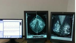 新型X光乳腺成像方式--辐射降低25倍，分辨率提...