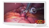 索尼推出4K 3D医疗显示器 大幅度提高医生手术...