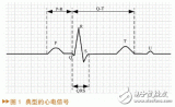 如何設計一個基于MATLAB/SIMULINK的心電信號仿真方法？