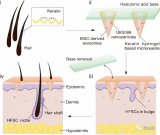 ACS Nano在线刊登了一种帮助生发的微针贴片,实现“取之于发,用之于发”