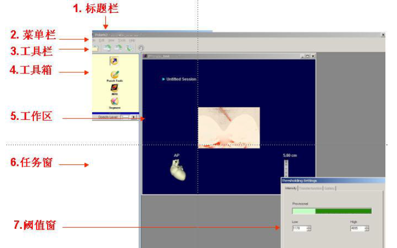 CT<b class='flag-5'>圖像</b>的<b class='flag-5'>處理</b><b class='flag-5'>流程</b>詳細概述