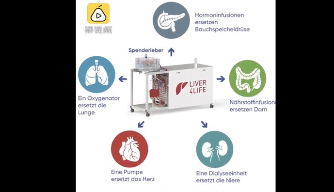 让肝脏在体外存活一个星期,新仪器助力更多供体肝脏用于器官移植