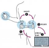 美國食品藥物管理局批準770G System