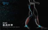国内首款肌肉外甲远也科技(Yrobot)宣布完成...