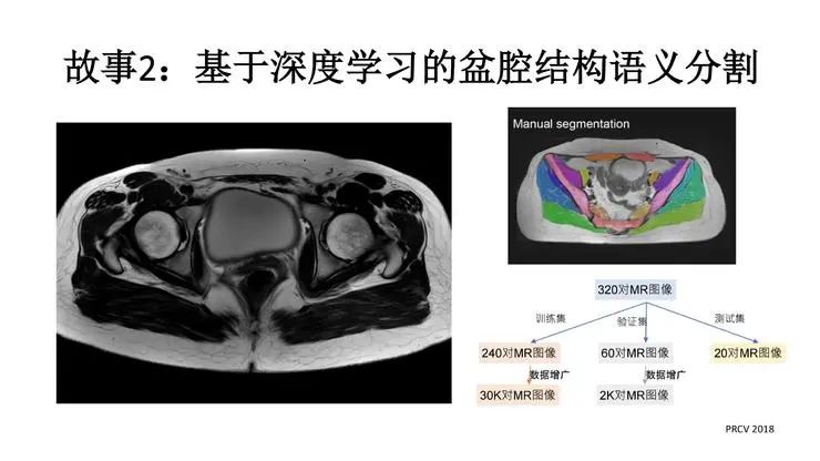 智能医疗