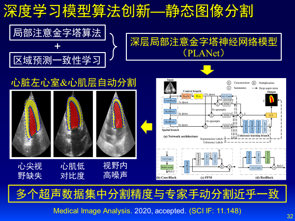 人工智能