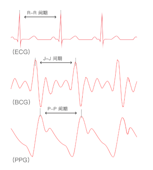 BCG传感器